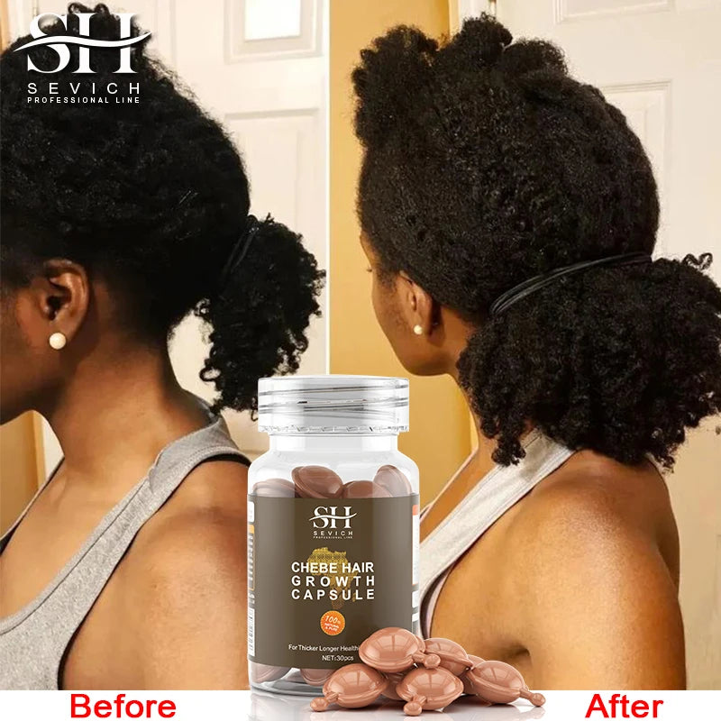 Fast Hair Growth Oil African Crazy Traction Alopecia Chebe Hair Mask Anti Hair Break Hair Strengthener Hair Loss Treatment Spray