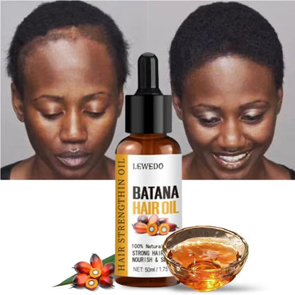 Olio di Batana Puro 100% Crescita e Anti-Caduta | LEWEDO. TK